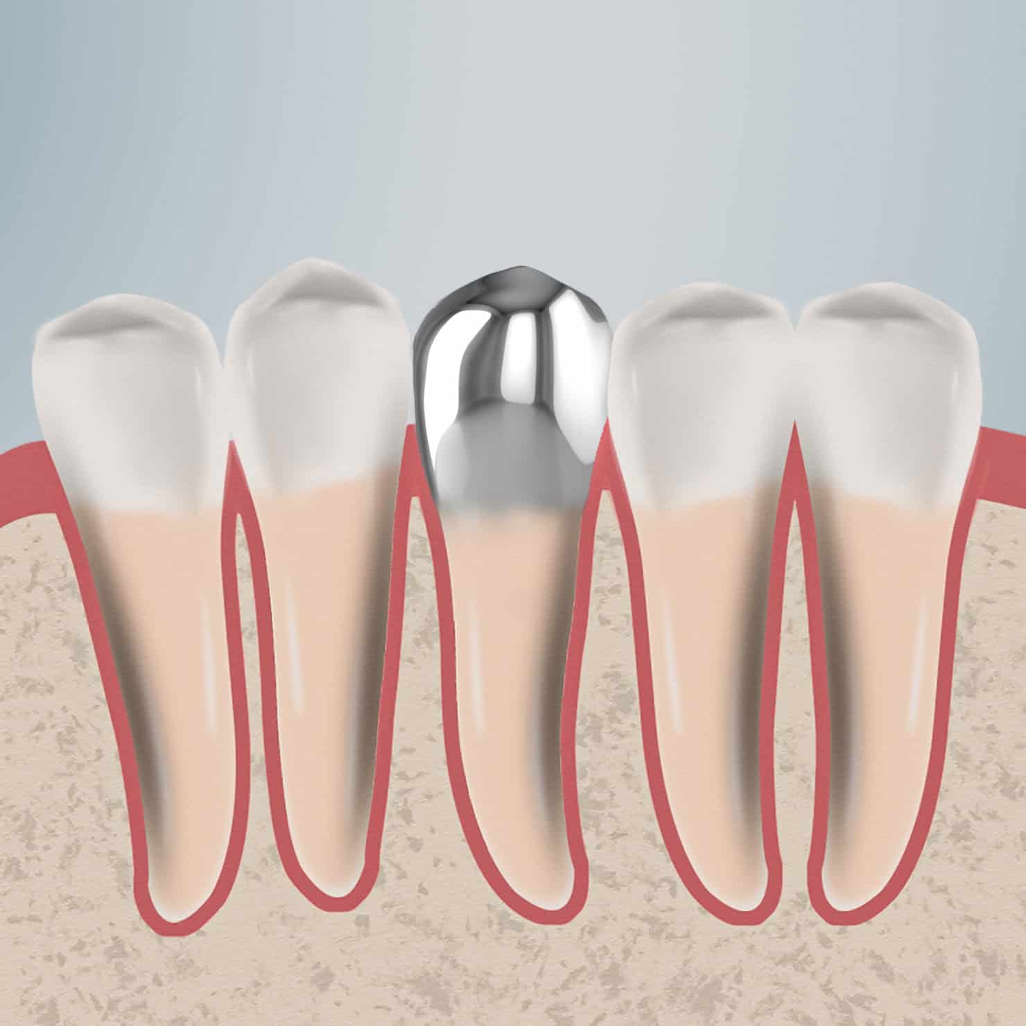 procedure